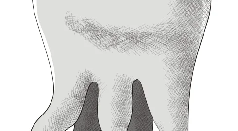 ​